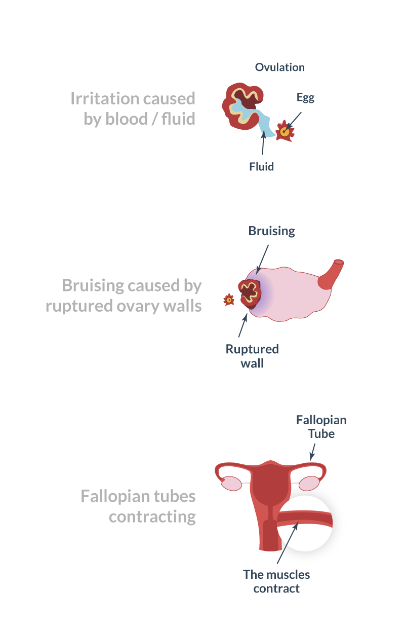 Cramping Pain During Or After Ovulation Are You Pregnant 